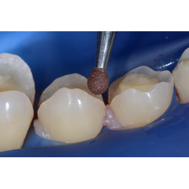 fraise de polissage boule