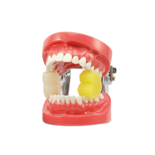 cale dentaire adulte